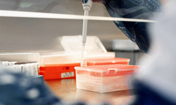 Cutting-edge Component Research and Extraction